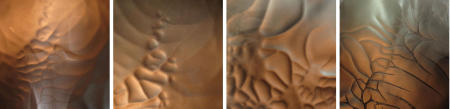 X-Ray Series Collection 12 Untitled 21, 34, 36, 26  each 18x18