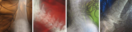 X-Ray Series Collection 5 Untitled 43, 8, 19, 39  each 16x16